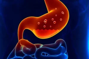 Dampak Serius Asam Lambung Jika Tidak Ditangani Memahami Risiko Dan Pencegahan