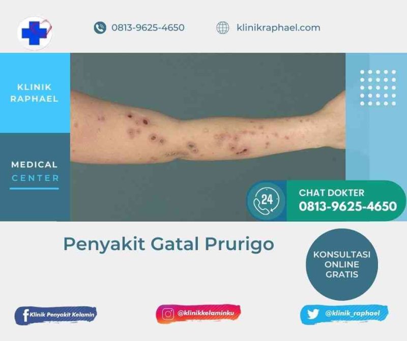 Kapan Kulit Gatal Perlu Pemeriksaan Dokter Memahami Tanda Peringatan Dan Langkah Tepat